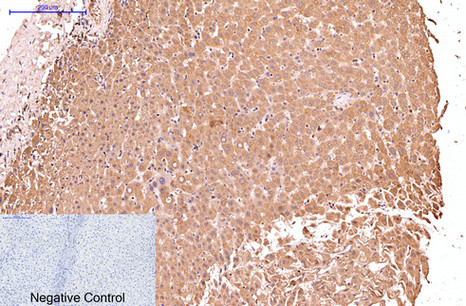 Cytokeratin 17 Ab