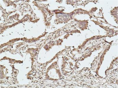 Histone H2B Ab