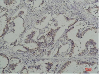 p-Tyrosine Ab