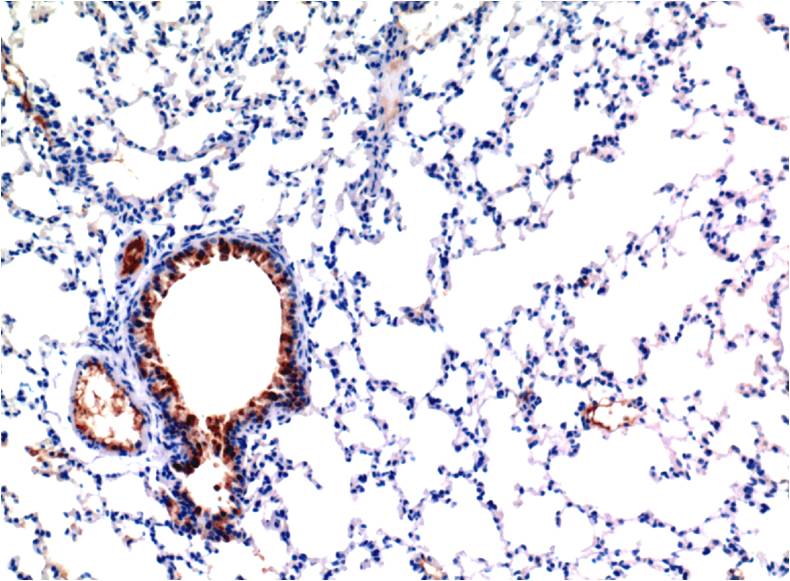 TGF beta 1 Ab