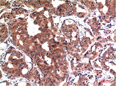 GSK 3 beta Ab