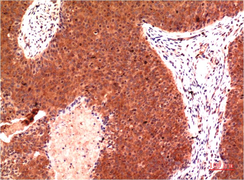 gamma 1 Tubulin Ab