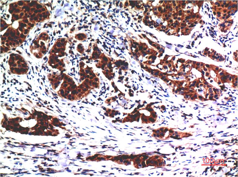 AKT1 Ab