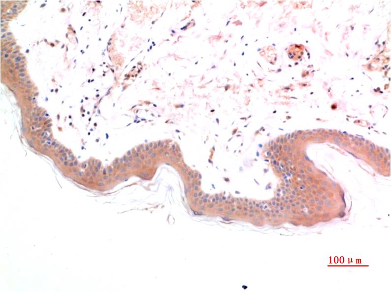 p-SMAD3 (S425) Ab