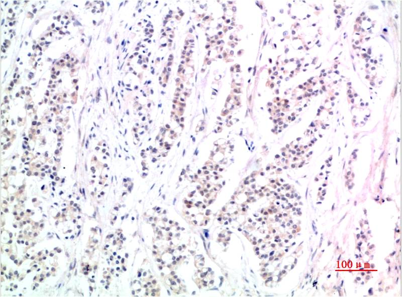 p-SMAD3 (S425) Ab