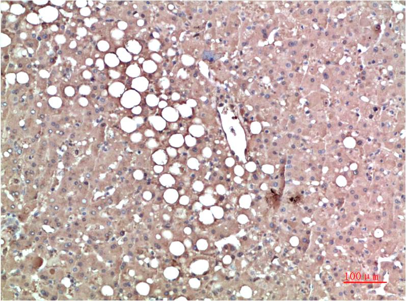 Transthyretin Ab