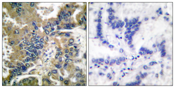 Cleaved-Caspase 1 p20 Ab