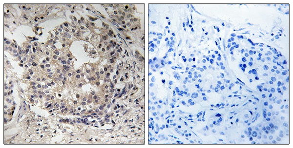 p-RPS6 (S235/S236) Ab