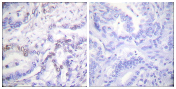 p-Histone H3 (T3) Ab