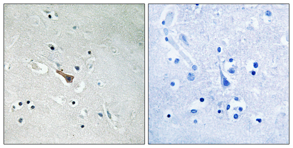 p-APLP2 (Y755) Ab