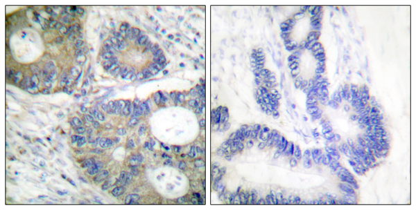 4E BP1 Ab