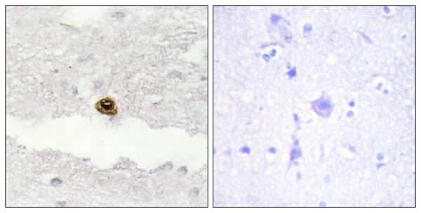 DAG kinase zeta Ab