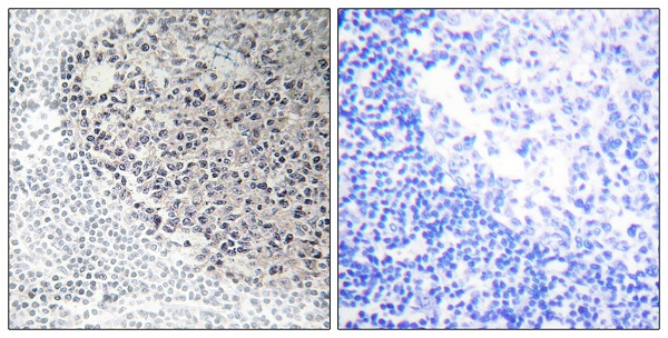 Collagen IX alpha 3 Ab