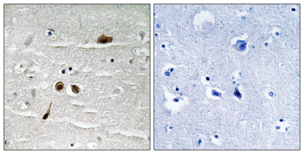 p-MDC1 (S513) Ab