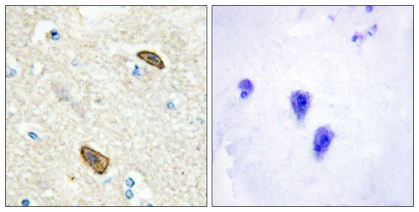 PLXDC1 Ab