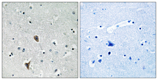 Oxidation resistance protein 1 Ab