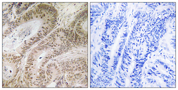 RDM1 Ab