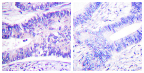 p-WASF1 (Y125) Ab