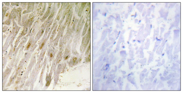 CEBP gamma Ab