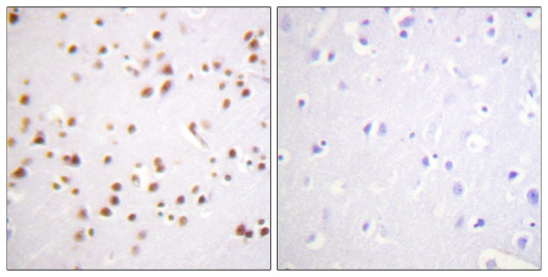 delta Catenin Ab