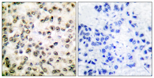 CREB binding protein Ab