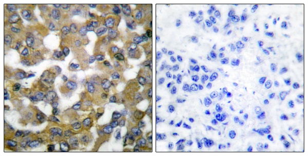 Cytokeratin 19 Ab