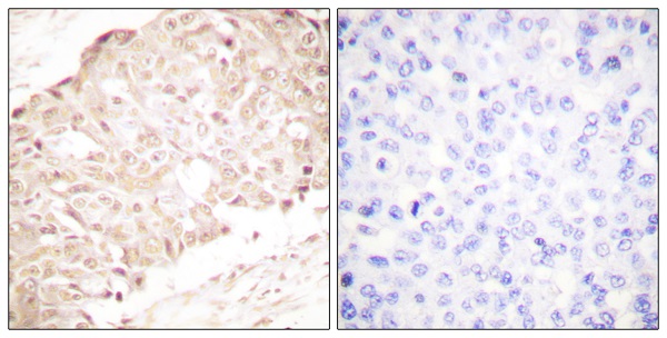 SENP1 Ab