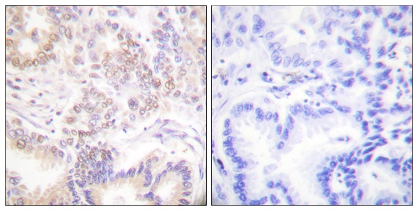 SENP5 Ab