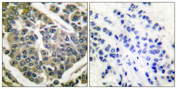 Collagen IV alpha 1 Ab