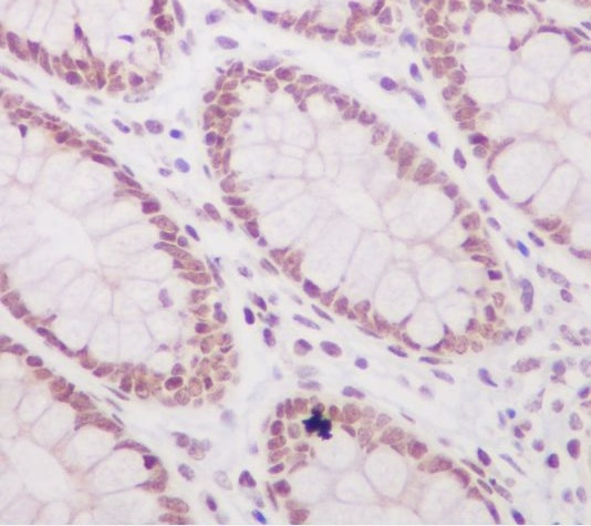 Acetyl-Histone H3 (K56) Ab