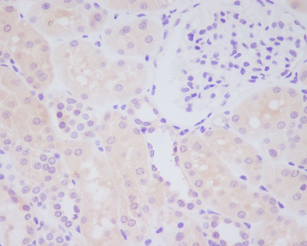 MMP14 Ab
