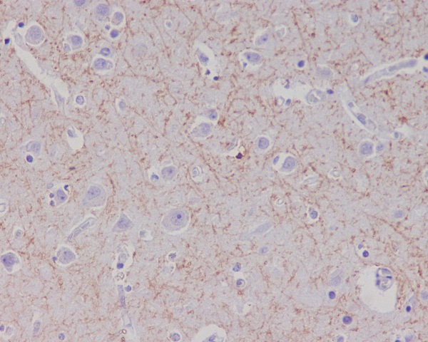 Amyloid beta A4 Ab