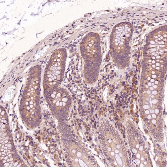 Cleaved-PARP 1 (D214) Ab