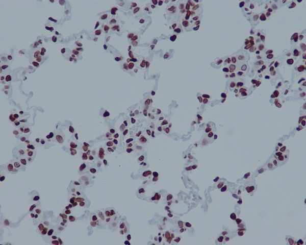 Acetyl-Histone H4 (K16) Ab