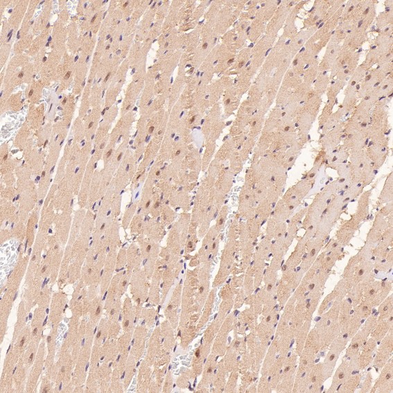 p95 NBS1 Ab