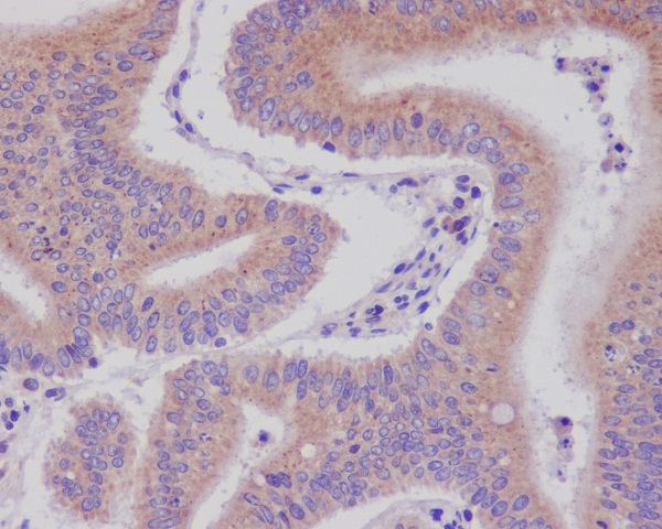 DNAJC15 Ab