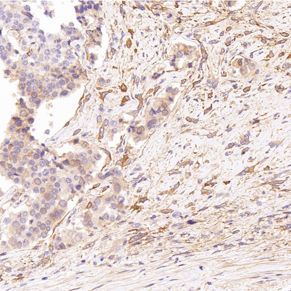 Glutamine synthetase Ab