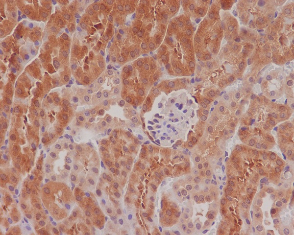 p-eIF4E (S209) Ab