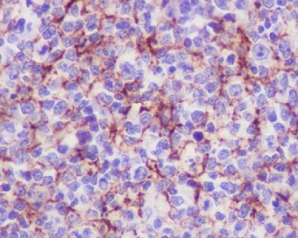 VCAM1 Ab