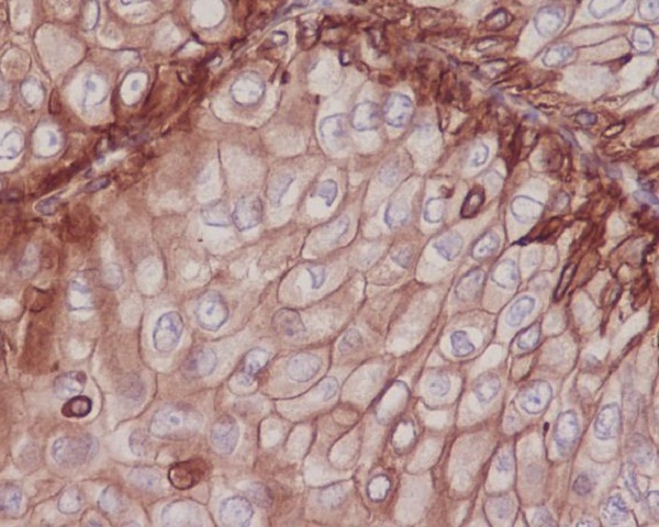 Integrin beta 1 Ab