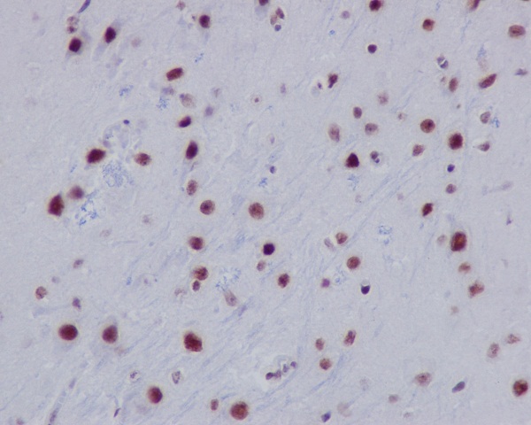 Acetyl-Histone H2A (K9) Ab