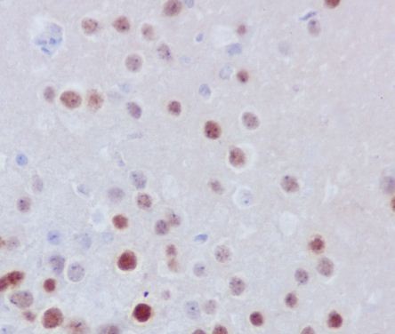 FOSB Ab