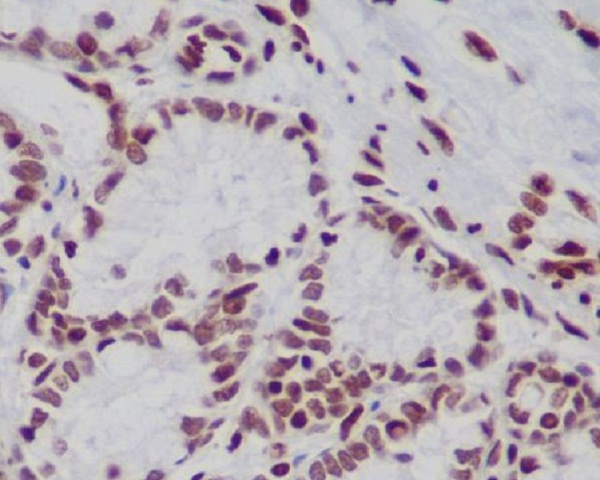 Mono/Di/TriMethyl-Histone H3 (K79) Ab