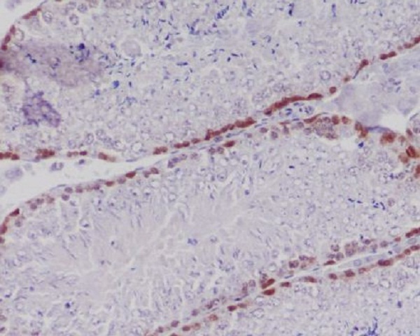 Caspase 2 Ab