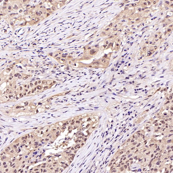 Hsp70 Ab