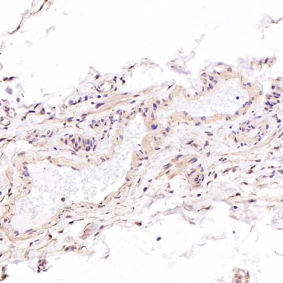 Hsp70 Ab