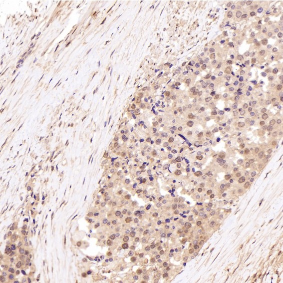Hsp70 Ab