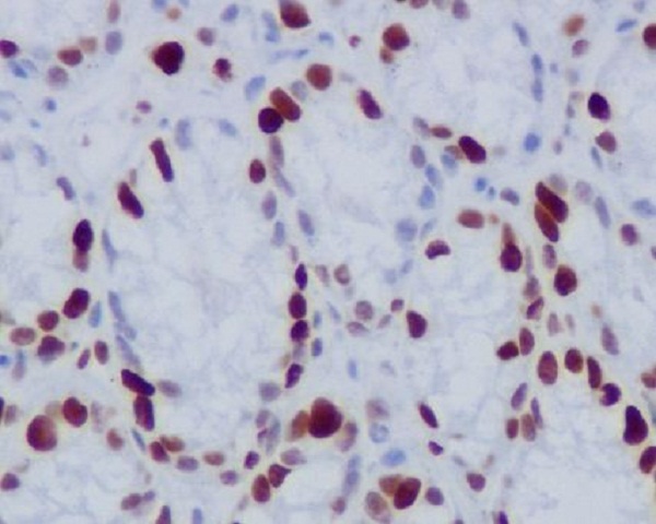p-Histone H1.4 (T17) Ab