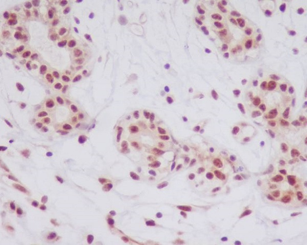 p-JNK1/2/3 (T183/T183/T221) Ab