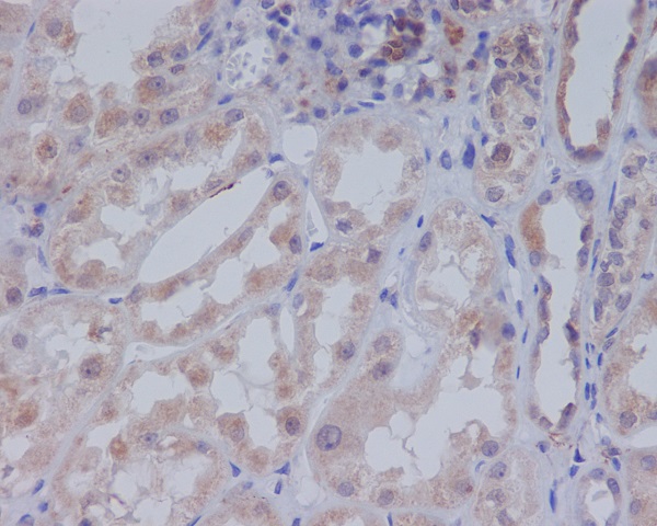 Acetyl CoA carboxylase Ab
